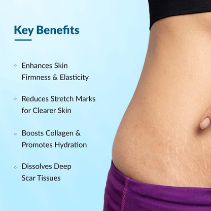 Fixderma Strallium Stretch Mark Cream | 75gm